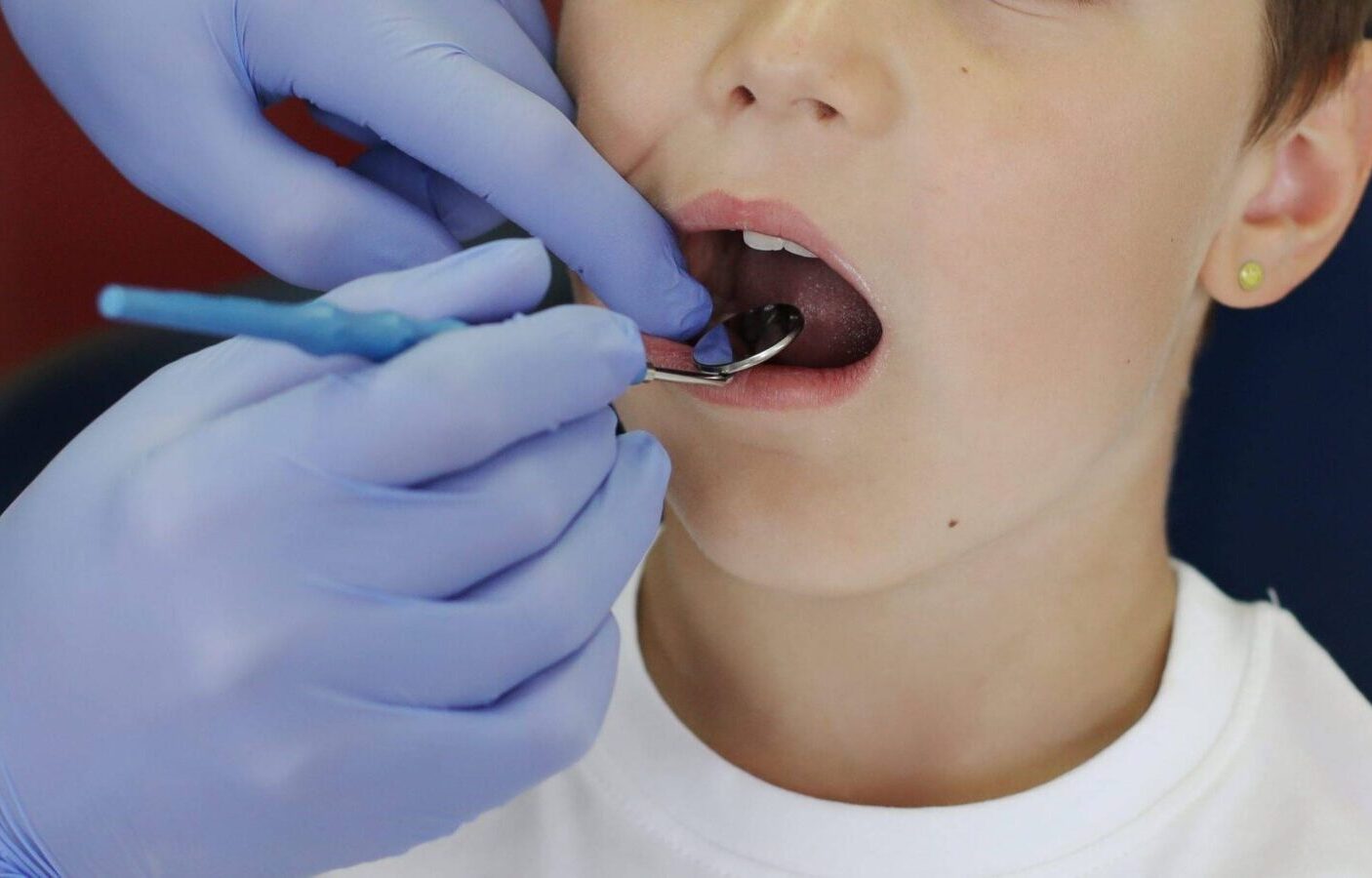 Notfallzahnmedizin und Schmerztherapie bei Lipident Weinfelden